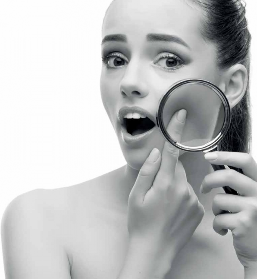 Akne u odrasloj dobi